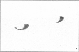 Фото 2. Портрет: в) карандашная ретушь глаз на обратной стороне промежуточного негатива 2б.